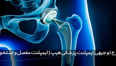 طرح توجیهی تولید ایمپلنت پزشکی هیپ